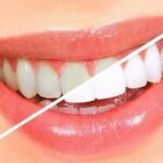 کلر آب چه تاثیراتی برای دندان ها دارد ؟