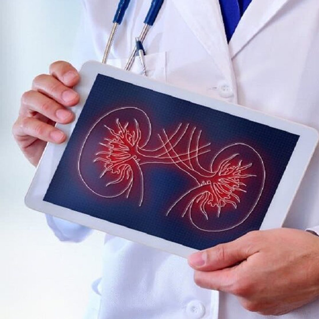 با دستگاه های تصفیه آب مشکل سنگ کلیه را حل کنیم